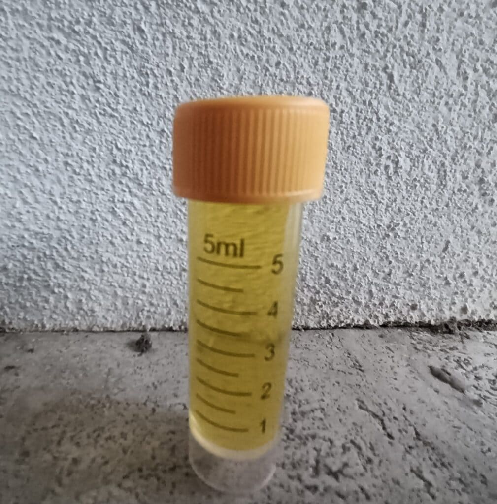 Analisi chimica di un campione prelevato durante la diagnosi di un’infiltrazione